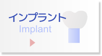 当院のインプラントについて